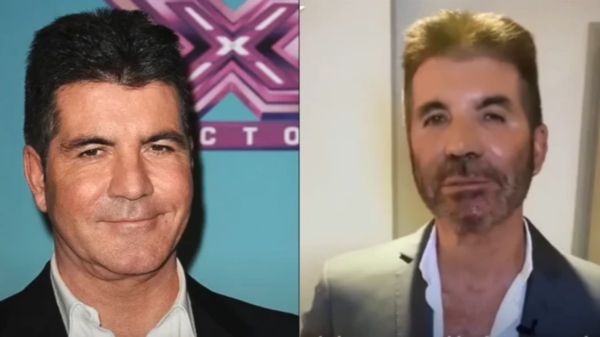 What Happened to Simon Cowell's Face?