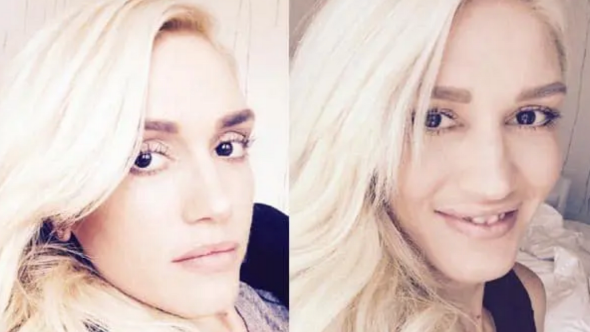 Gwen Stefani is posing without makeup in a side by side.
