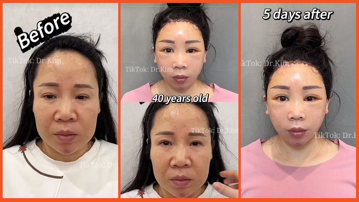 Dr. Kim Plastic Surgery TikTok, Explained