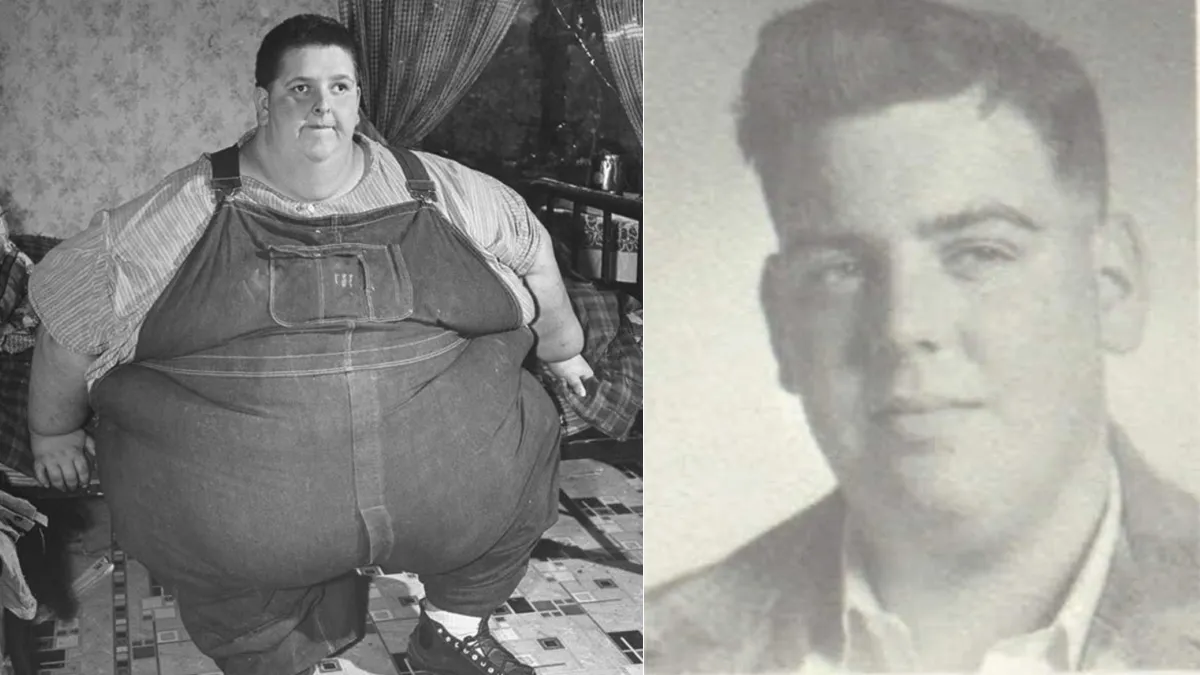 What Is the Story of Jon Brower Minnoch, the ‘Fattest Person in the World?’