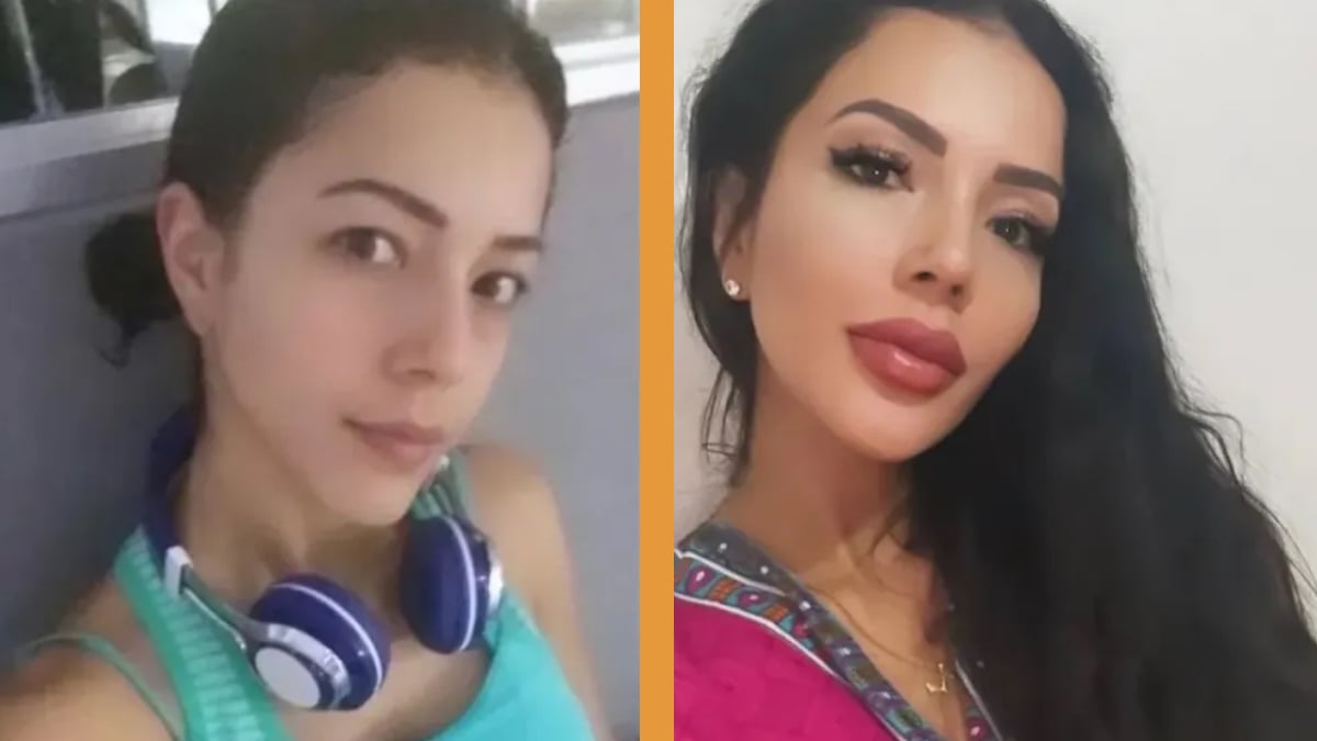 Jasmine from '90 Day Fiance' before surgery, confirmed