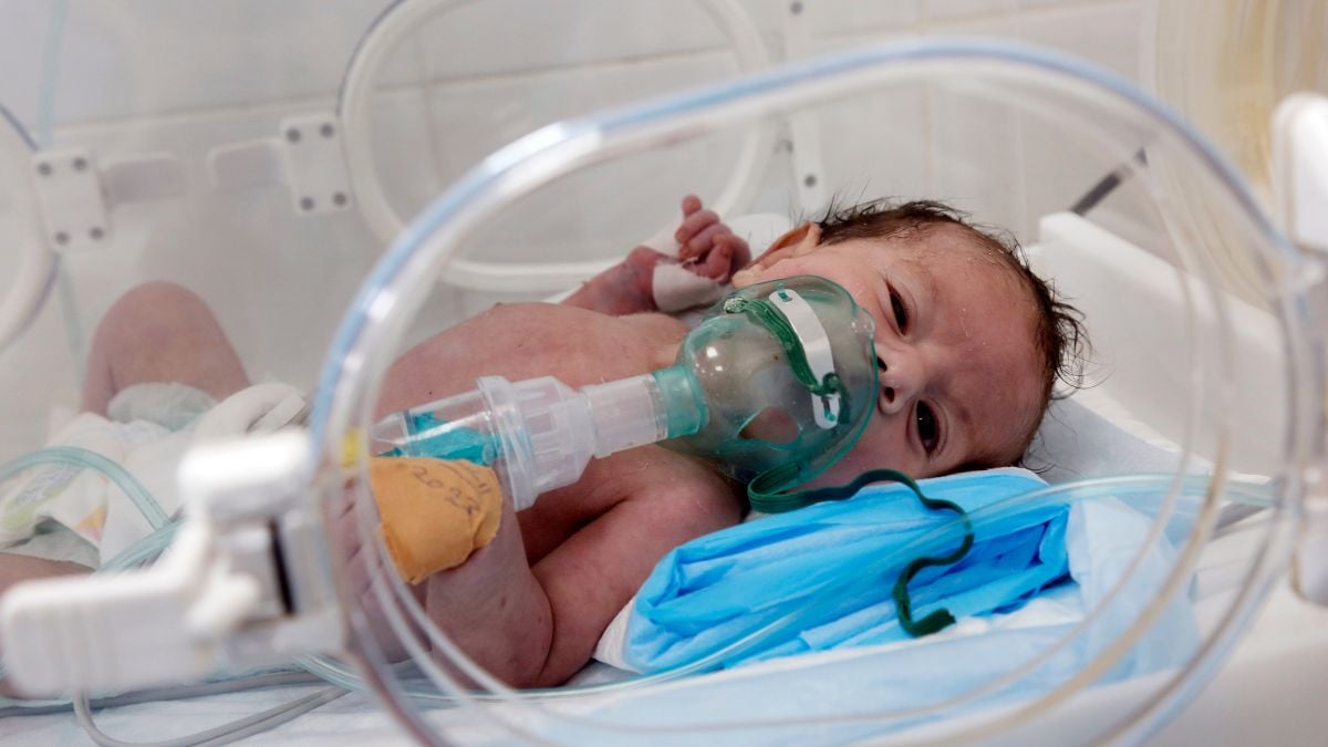 An infant in NICU