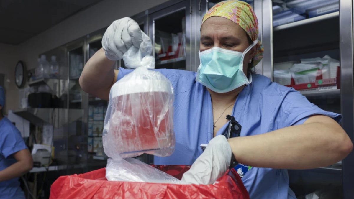 Pig kidney being prepared for transplantation.