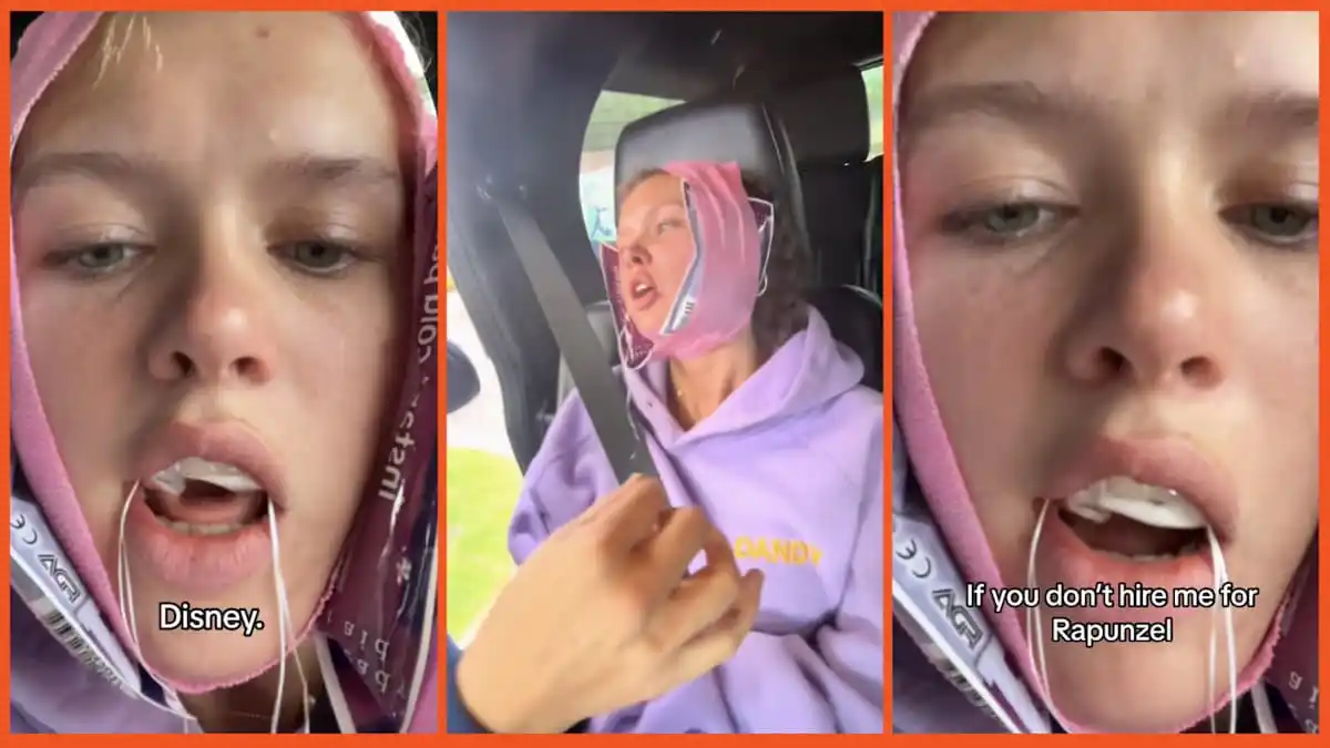 'Disney, you heard her': Woman gets her wisdom teeth out and ends up so high she records spectacularly demented Disney audition