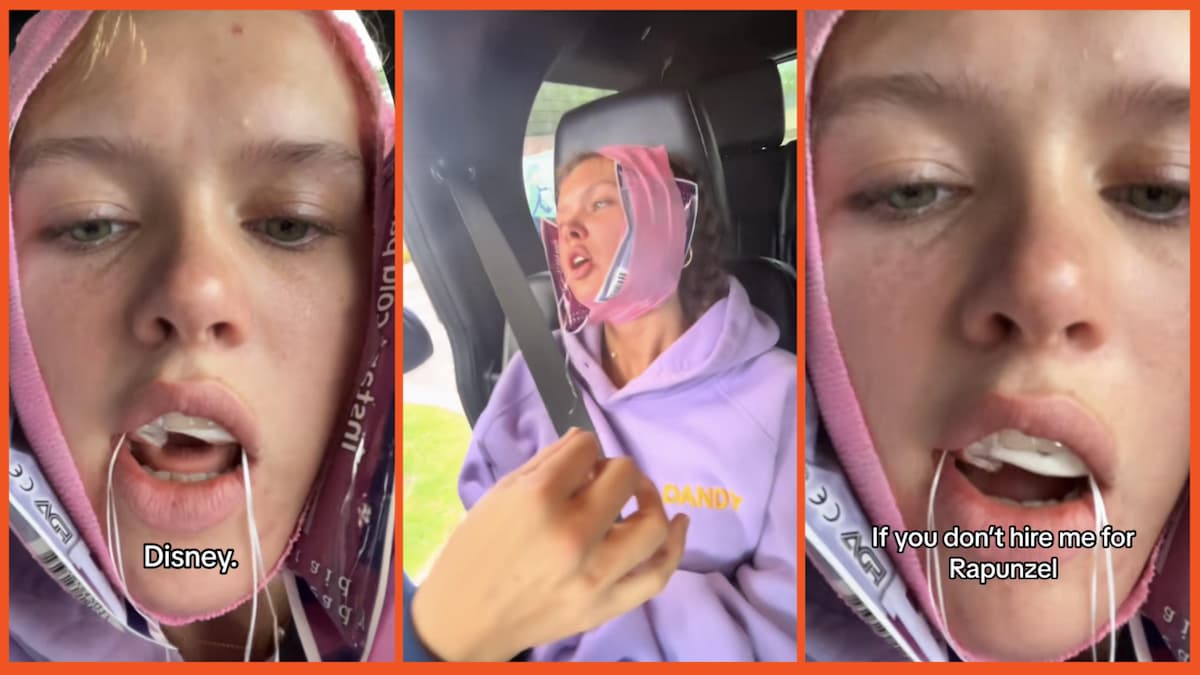 ‘Disney, you heard her’: Woman gets her wisdom teeth out and ends up so high she records spectacularly demented Disney audition