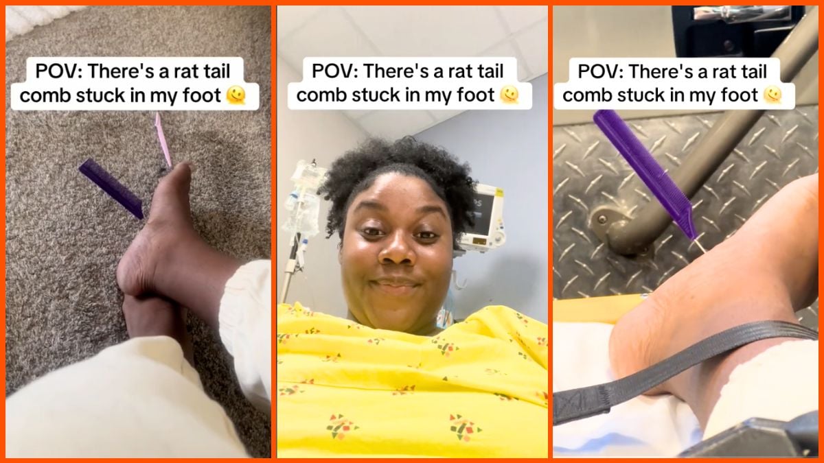 Tiktok user gets a comb stuck in her foot