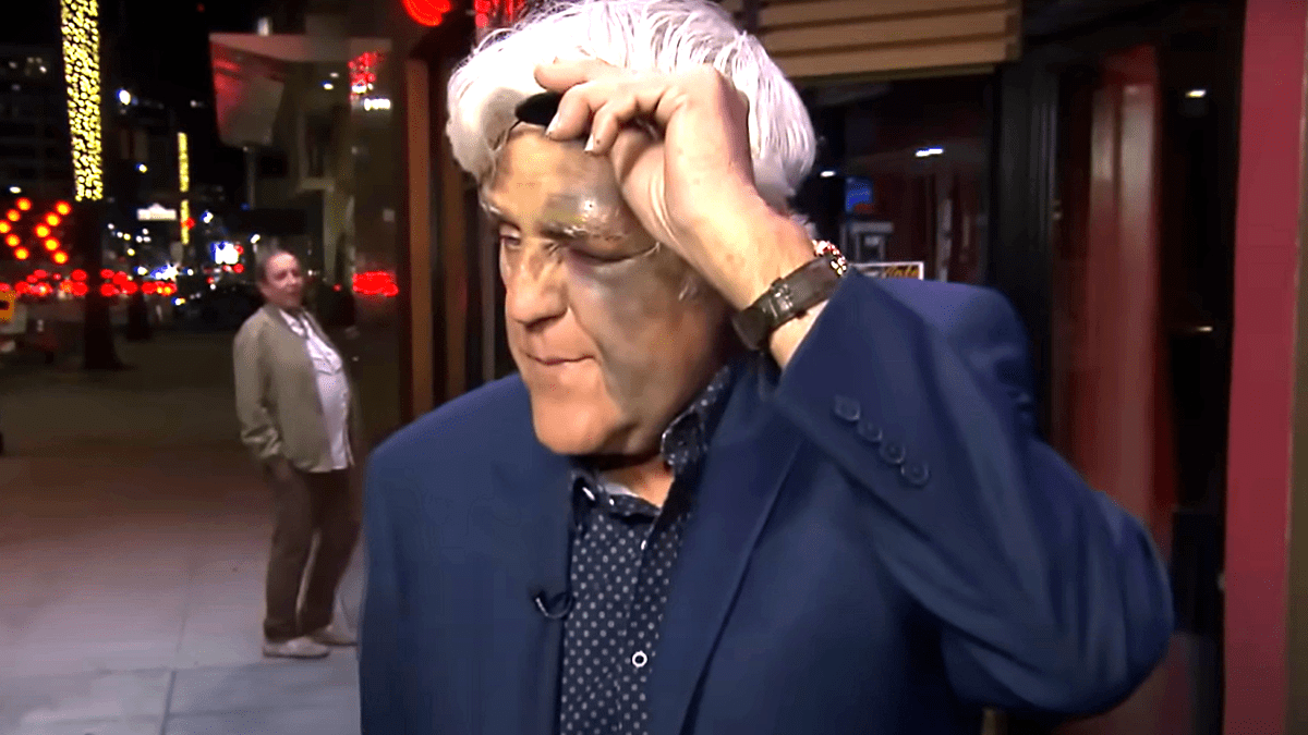 Jay Leno's bruised eye and face