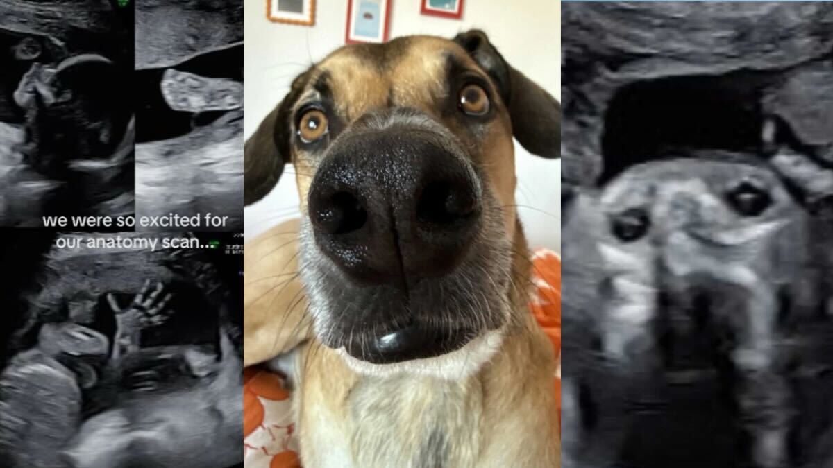 TikTok mom shares sonograms of her baby looking like her dog