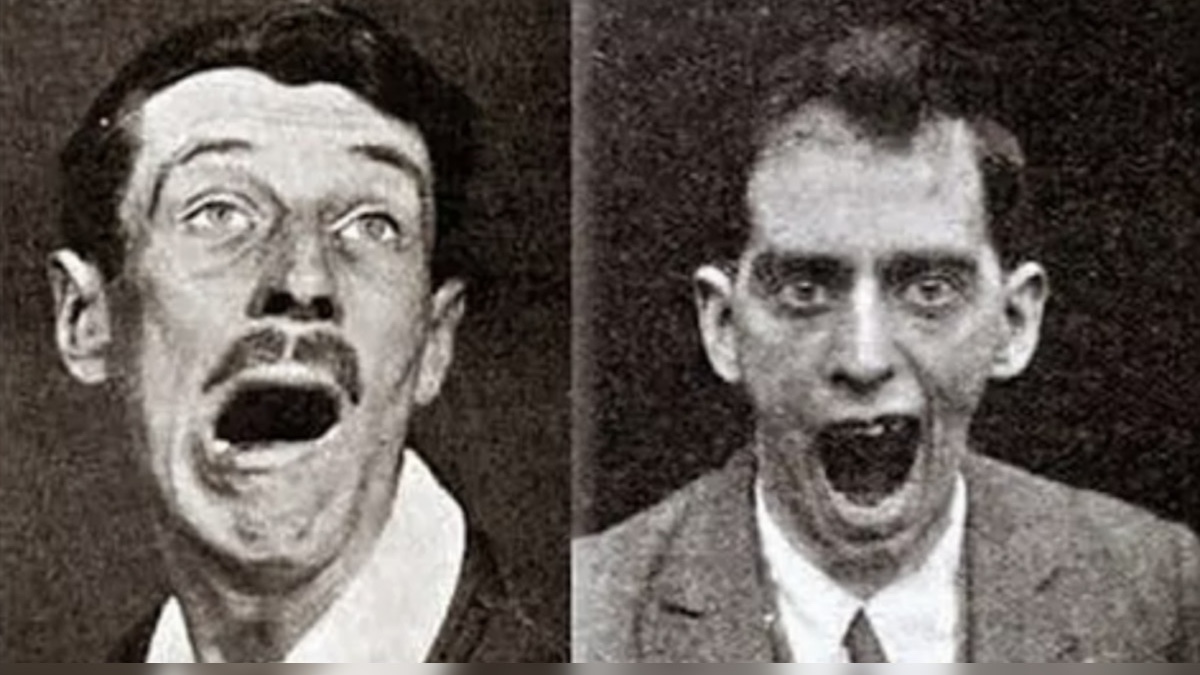 Encephalitis lethargica patients via Wiki Commons, Medicalcortex