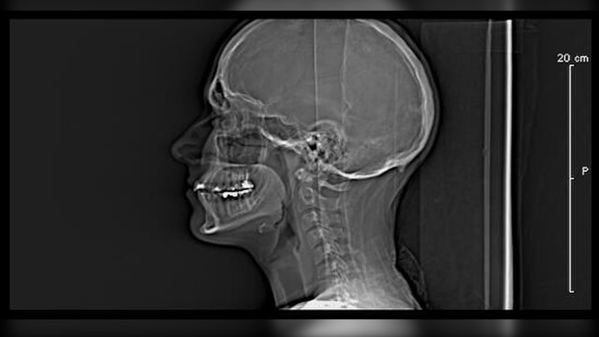 X Ray via Wiki Commons, Nyechologist
