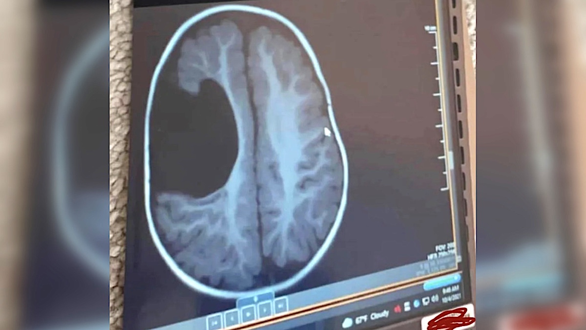 via Brooklynlikestories, Reddit